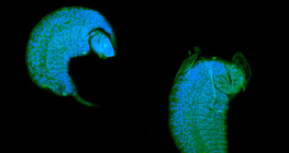 Iichneumon wasp larva developing as a parasite in drosophila pupa