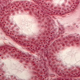 Section of seminiferous tubules