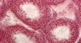 Section of seminiferous tubules