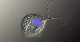 The causative agent of Trichomonas vaginalis (differential interference contrast image, the nucleus is stained blue)