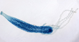 Freshwater hydra (stained)