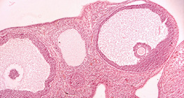 Transverse section of ovary (mammal)