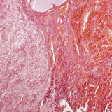 Pituitary gland (longitudinal section, low magnification)