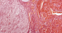 Pituitary gland (longitudinal section, low magnification)