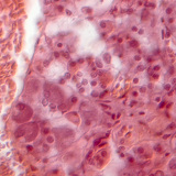 Section of pituitary gland