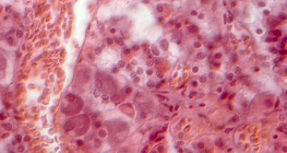 Section of pituitary gland