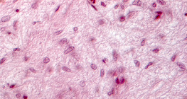Section of pituitary gland