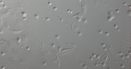 Red blood cells of a Drosophila larva