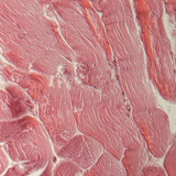 Tendon (cross section)