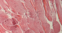 Tendon (cross section)