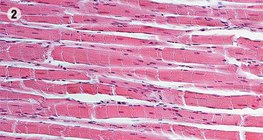 Muscle tissue