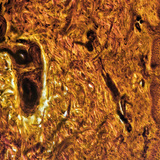 Напречен разрез на кожата на човешки пръст