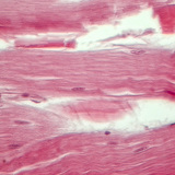 Tendon (longitudinal section)