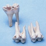 Molars