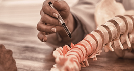 Degenerative spine diseases