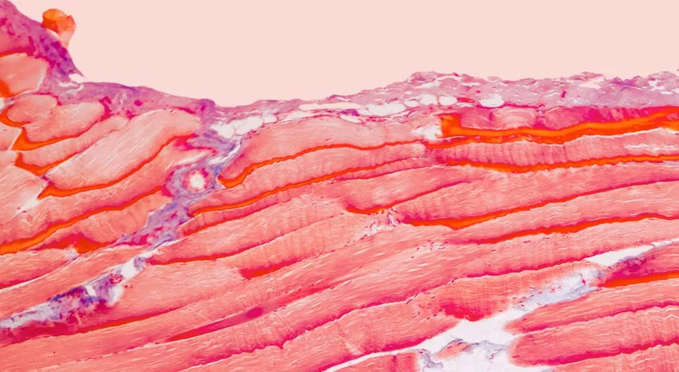 What tissues make up our muscles?