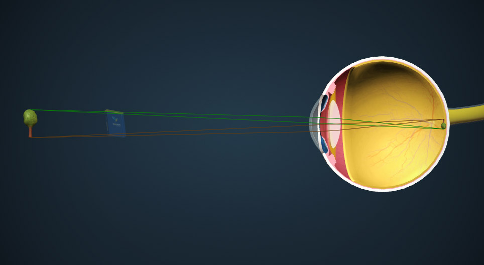 A formação da imagem no olho