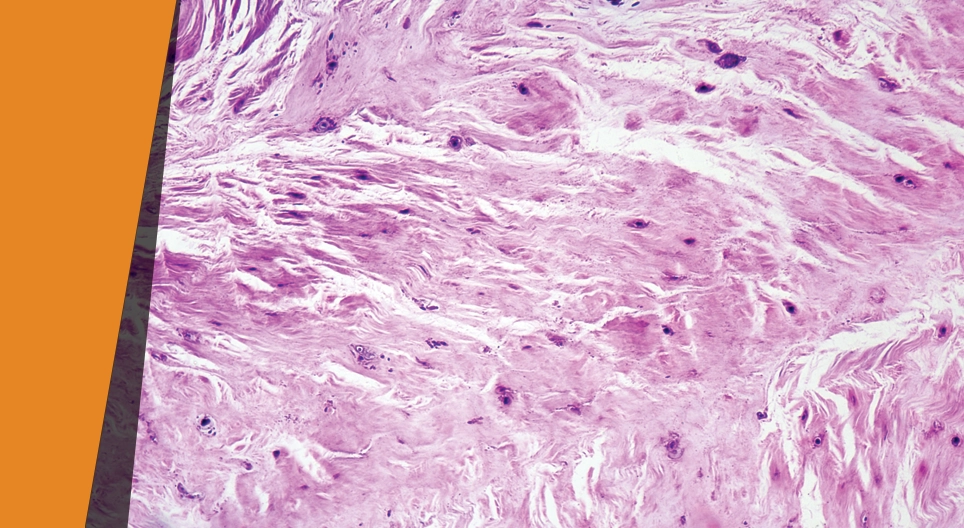 Направленный удар