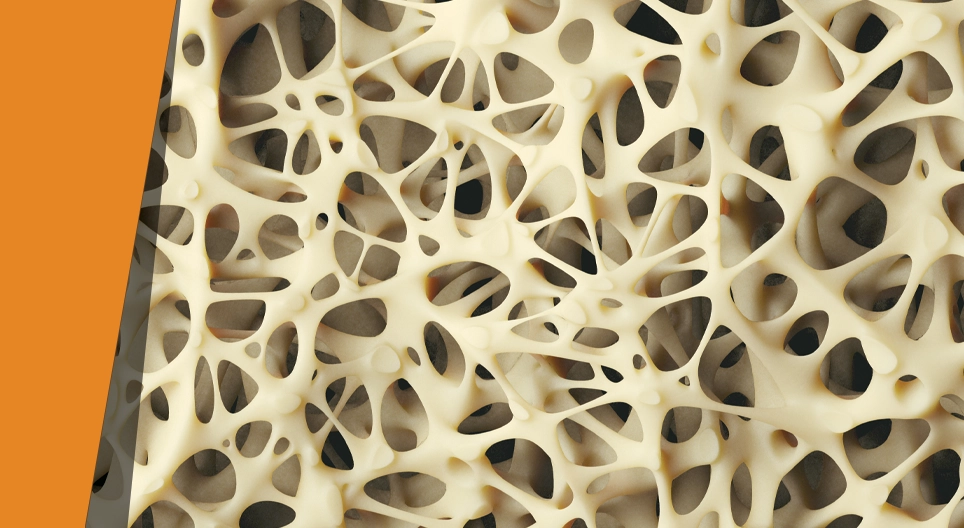 Brittle bone