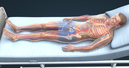 Deep vein thrombosis and pulmonary embolism