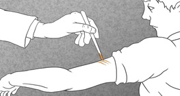 История на ваксините