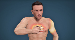 Heart attack