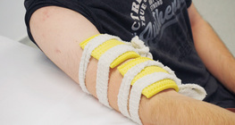 Electrical stimulation