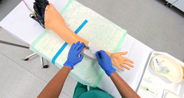 Short intravenous catheter placement – POV