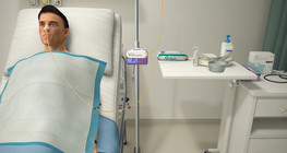 Nasogastric tube feeding