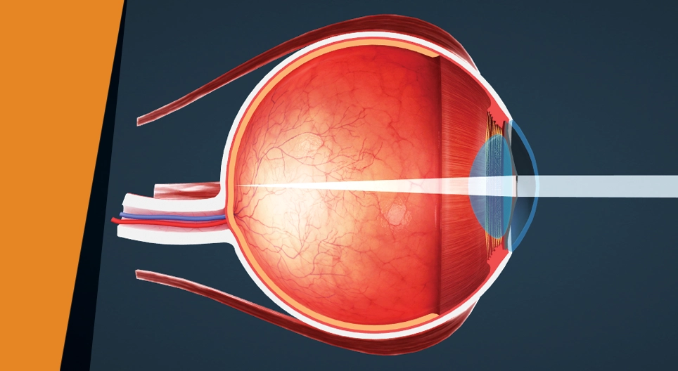 Сліпа пляма